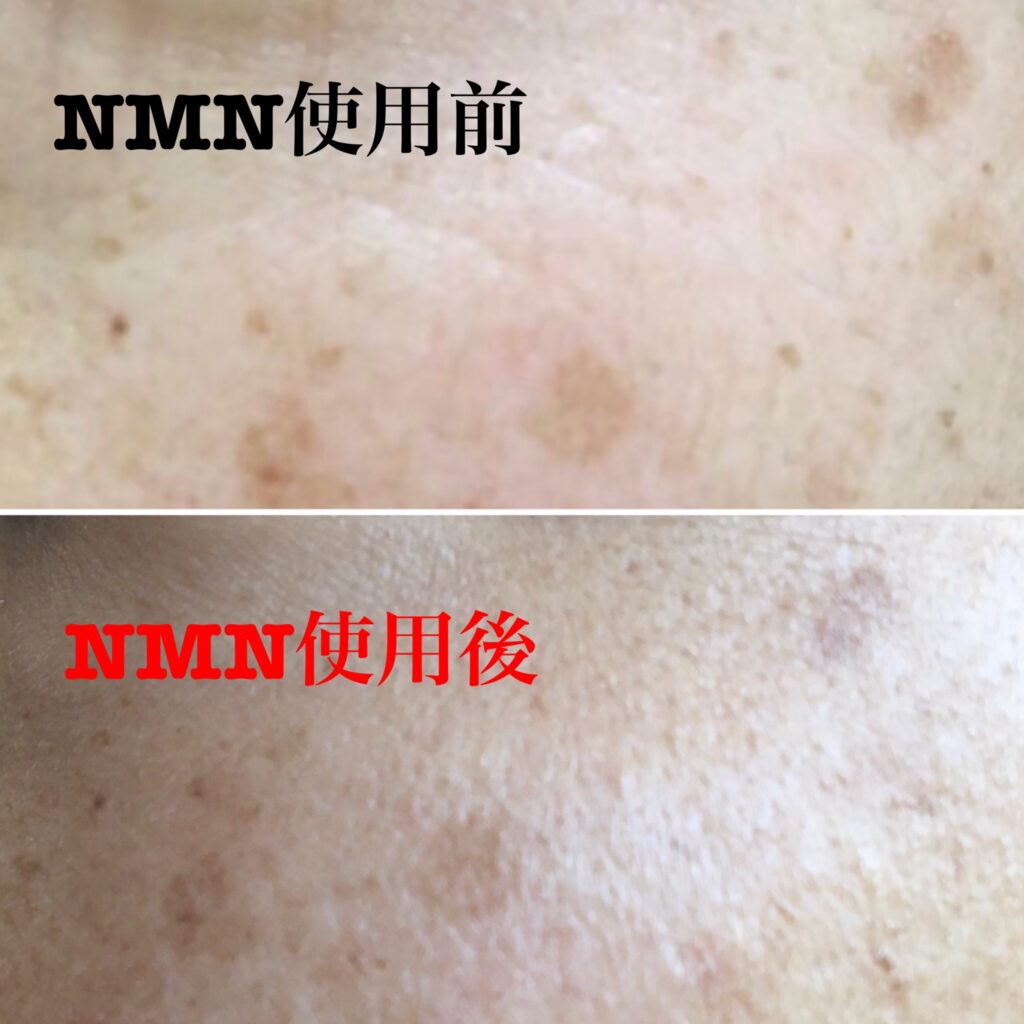 【新常識】NMN配合ジェルで肌の若返りと薄毛対策
